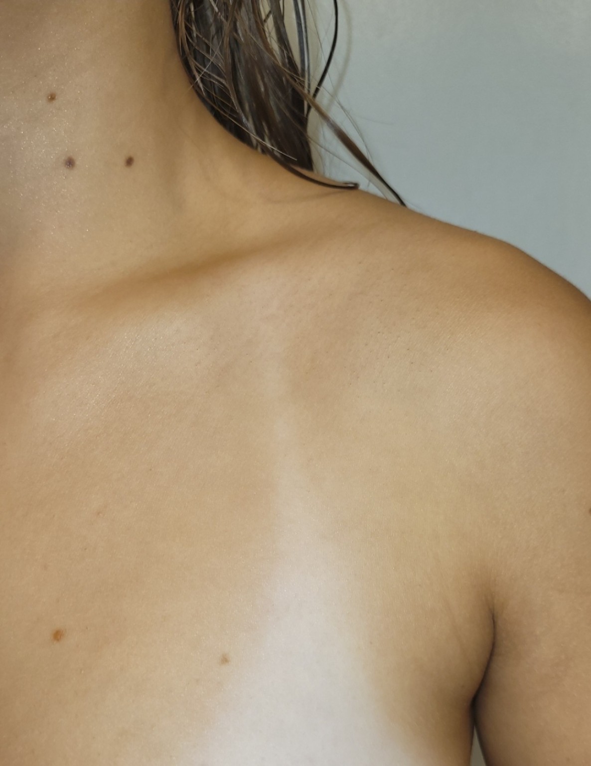 Client shoulder spray tan result